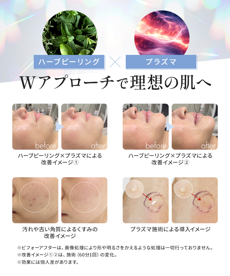 ハーブピーリング×プラズマ｜Wアプローチで理想の肌へ