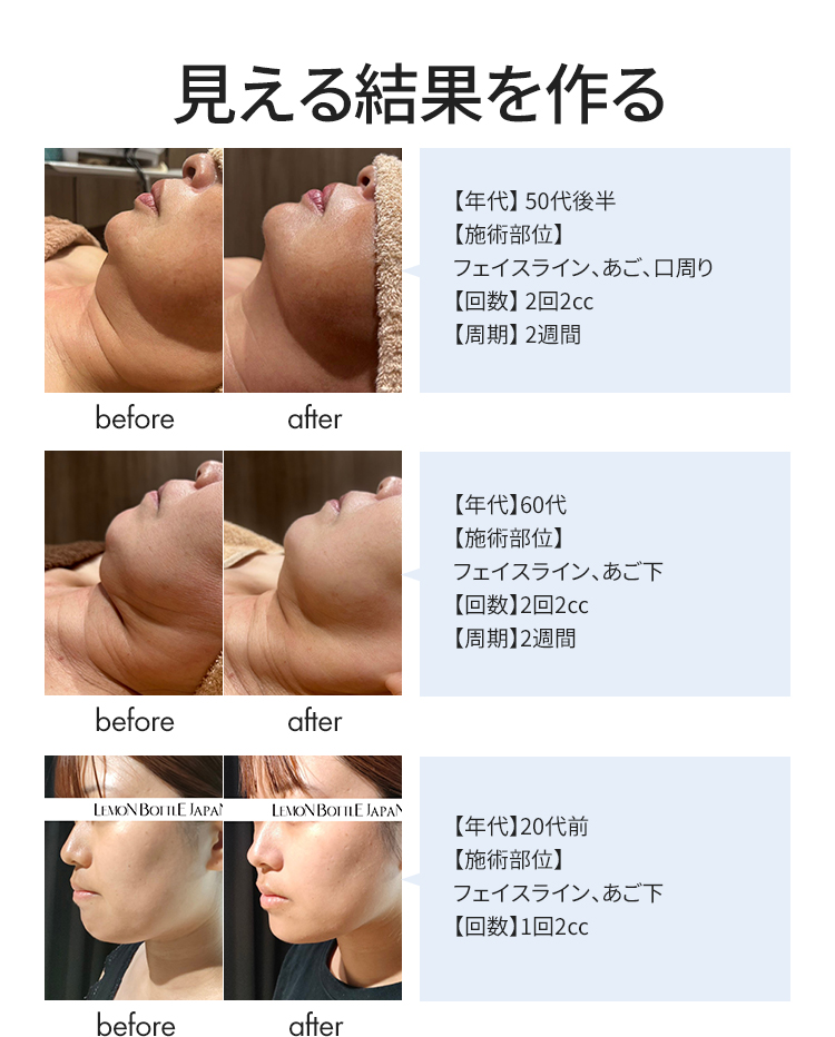 見える結果を作る